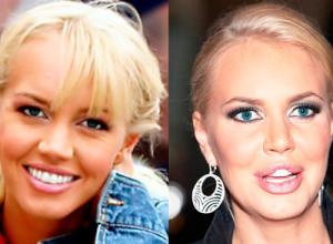 Malinivska Masha before and after plastic surgery: photo